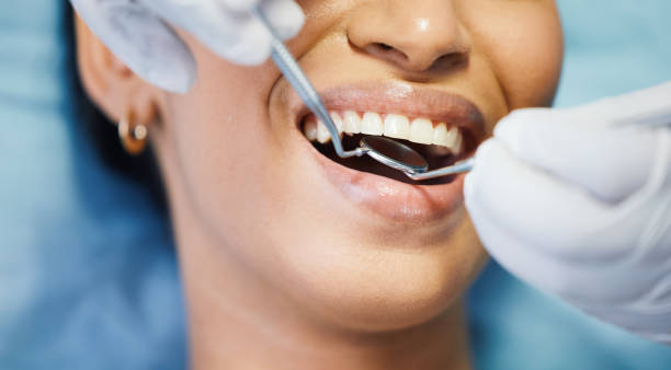 Best 24-Hour Dental Clinic Near Me  in Beale Af, CA