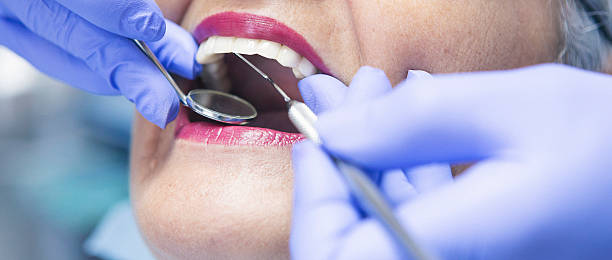 Best Dentist for Tooth Abscess  in Beale Af, CA